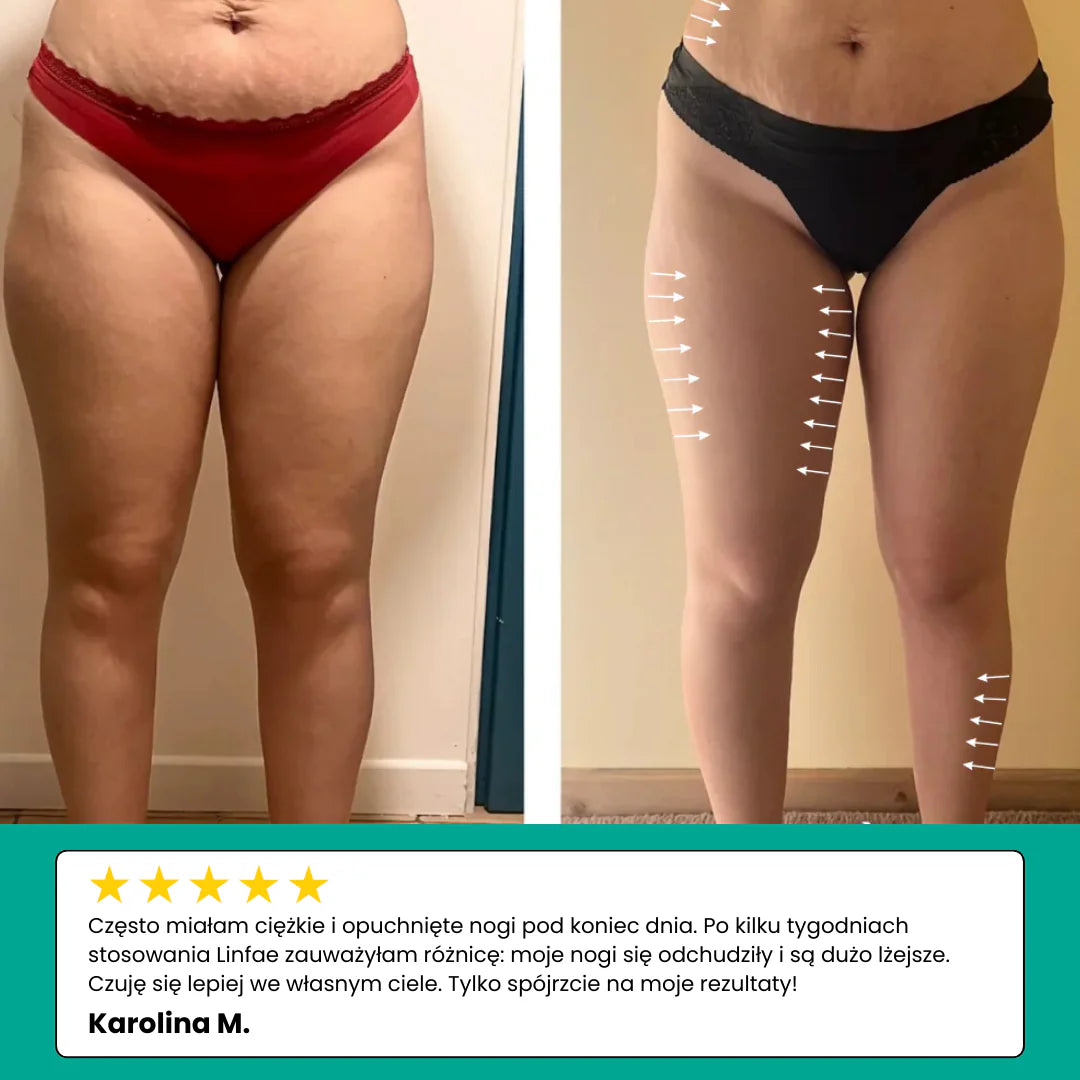 Luzyna – Drenaż Limfatyczny